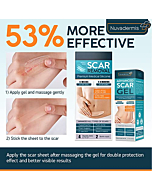 Bundle & Save - Save Big (20%) Off on Nuvadermis Silicone Scar Removal Sheets and Advanced Scar Gel