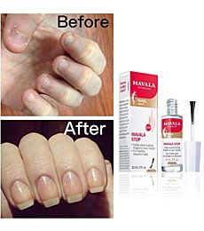 Mavala Stop Deterrent Nail Polish Treatment | Nail Care to Help Stop Putting Fingers In Your Mouth | For Ages 3+ | 0.3 Fl Oz